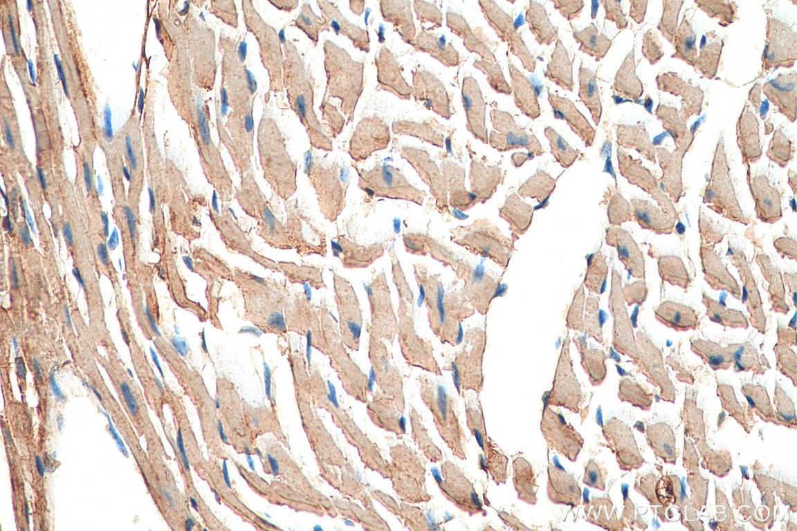 Immunohistochemistry (IHC) staining of mouse heart tissue using SPEG Polyclonal antibody (18716-1-AP)