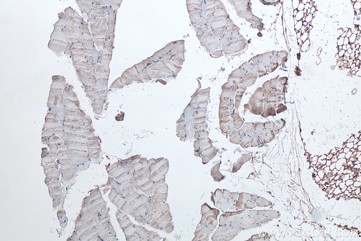 Immunohistochemistry (IHC) staining of mouse skeletal muscle tissue using SPEG Polyclonal antibody (18716-1-AP)