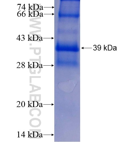 SPEG fusion protein Ag8330 SDS-PAGE