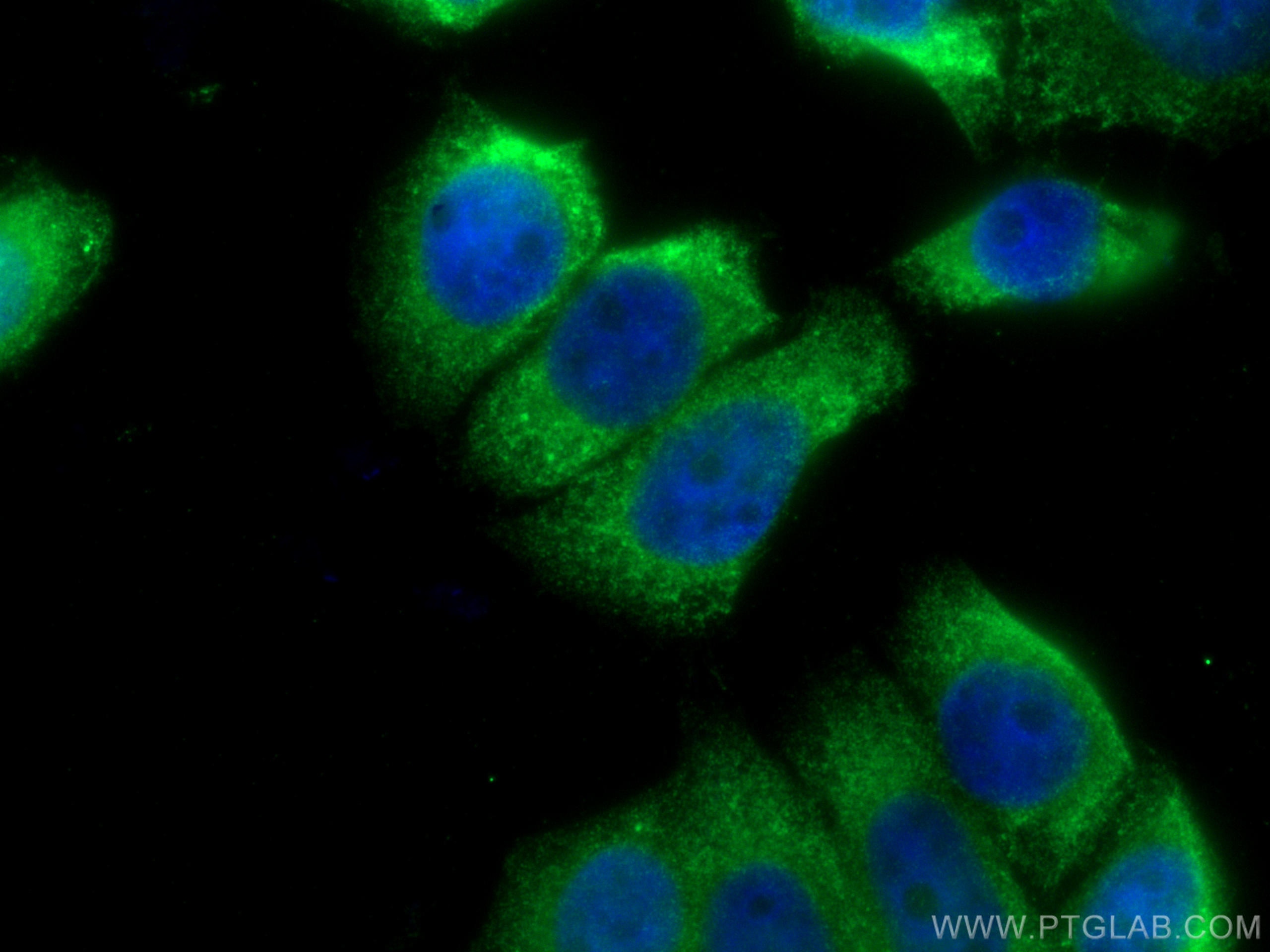 Immunofluorescence (IF) / fluorescent staining of PC-3 cells using SPERT Polyclonal antibody (17826-1-AP)