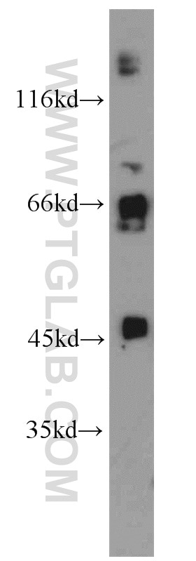 Western Blot (WB) analysis of PC-3 cells using SPERT Polyclonal antibody (17826-1-AP)
