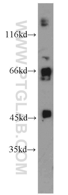 WB analysis of PC-3 using 17826-1-AP