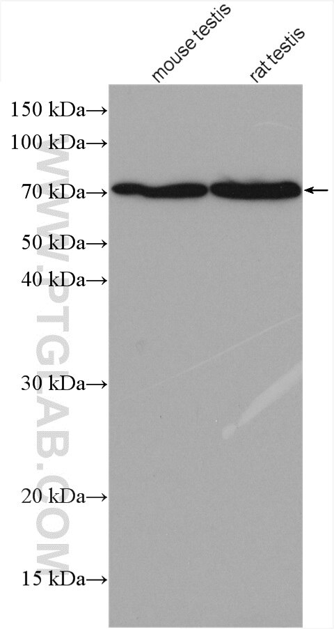 Western Blot (WB) analysis of various lysates using SPESP1 Polyclonal antibody (28010-1-AP)