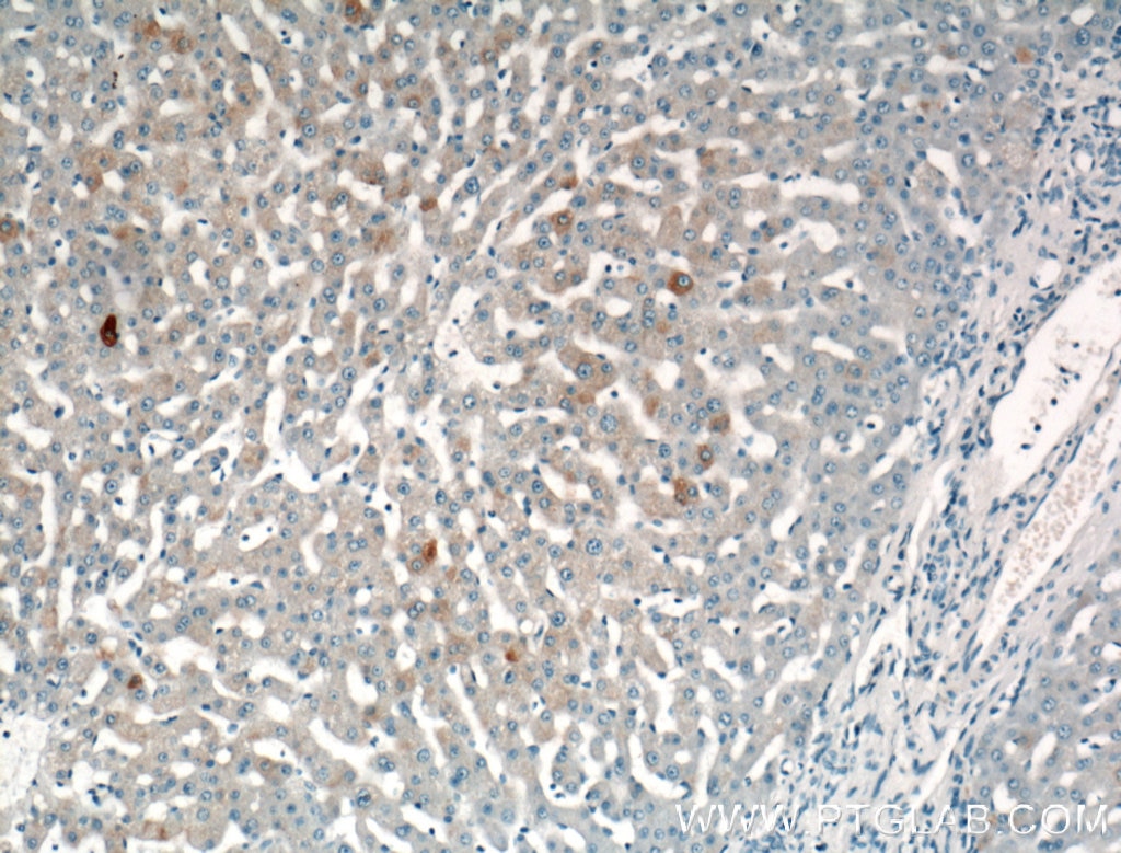 Immunohistochemistry (IHC) staining of human liver tissue using SPG11 Polyclonal antibody (16555-1-AP)