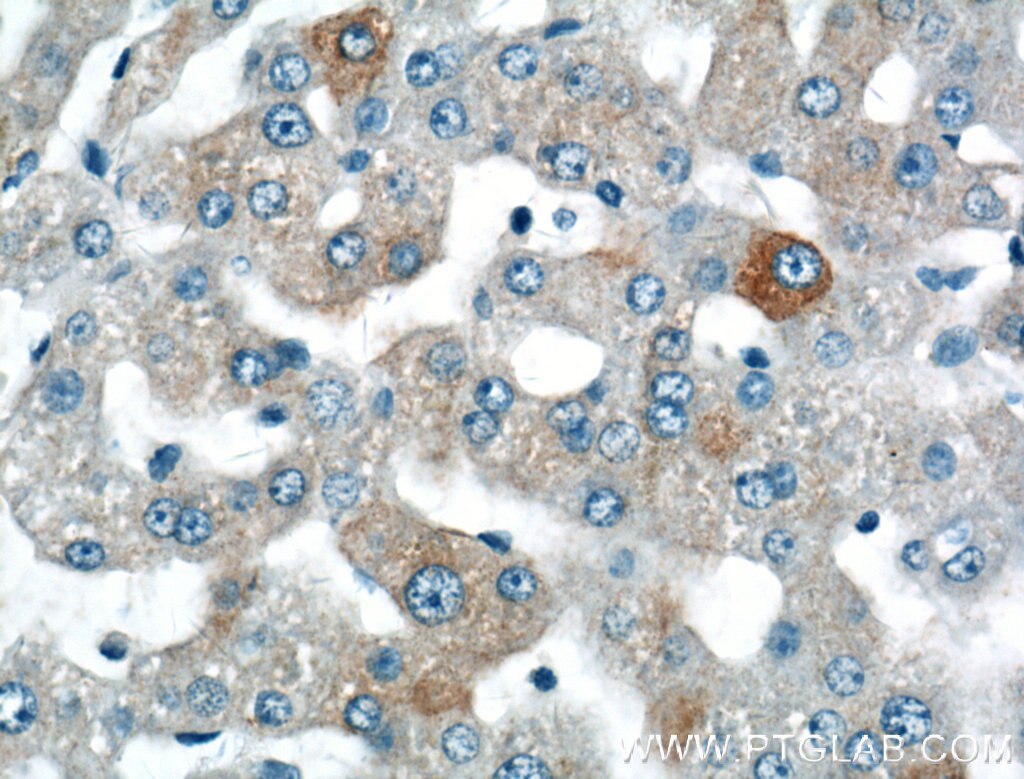 Immunohistochemistry (IHC) staining of human liver tissue using SPG11 Polyclonal antibody (16555-1-AP)