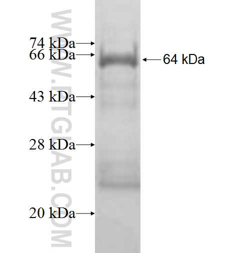 SPG11 fusion protein Ag9769 SDS-PAGE