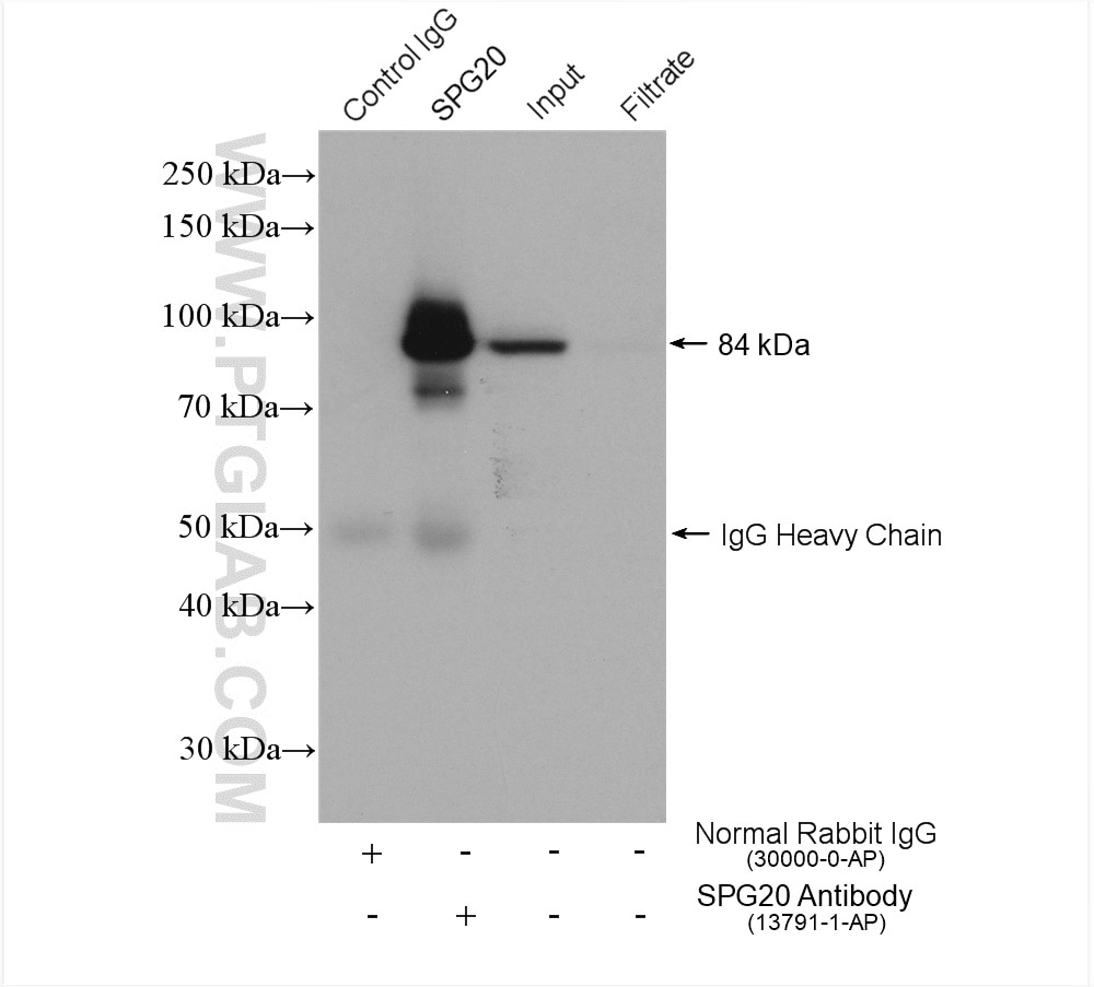 Immunoprecipitation (IP) experiment of HeLa cells using Spartin, SPG20 Polyclonal antibody (13791-1-AP)
