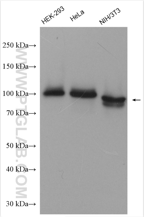 Western Blot (WB) analysis of various lysates using Spartin, SPG20 Polyclonal antibody (13791-1-AP)