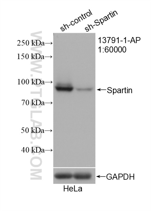 Western Blot (WB) analysis of HeLa cells using Spartin, SPG20 Polyclonal antibody (13791-1-AP)