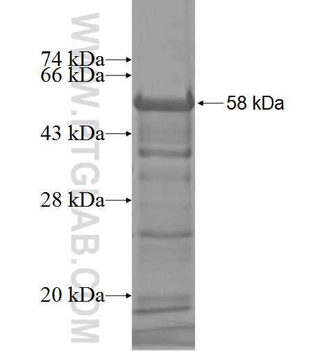 Spartin, SPG20 fusion protein Ag4934 SDS-PAGE