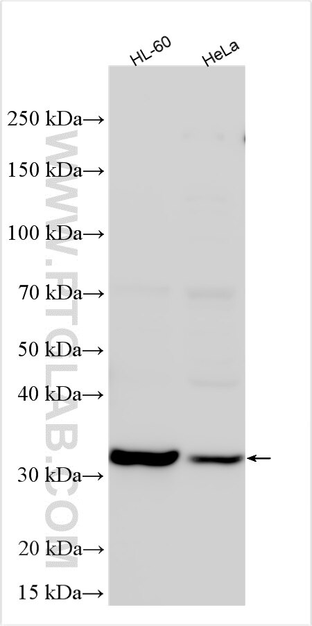 WB analysis using 19815-1-AP Western Blot (WB) analysis of various lysates using SPG21 Polyclonal antibody (19815-1-AP)