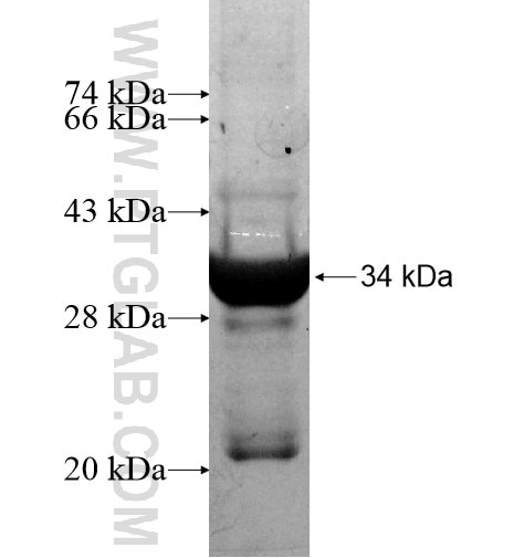 SPG21 fusion protein Ag14879 SDS-PAGE