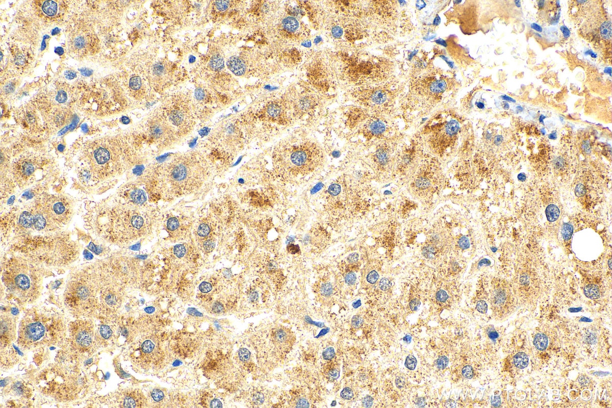 Immunohistochemistry (IHC) staining of human liver tissue using SPG7 Polyclonal antibody (27801-1-AP)