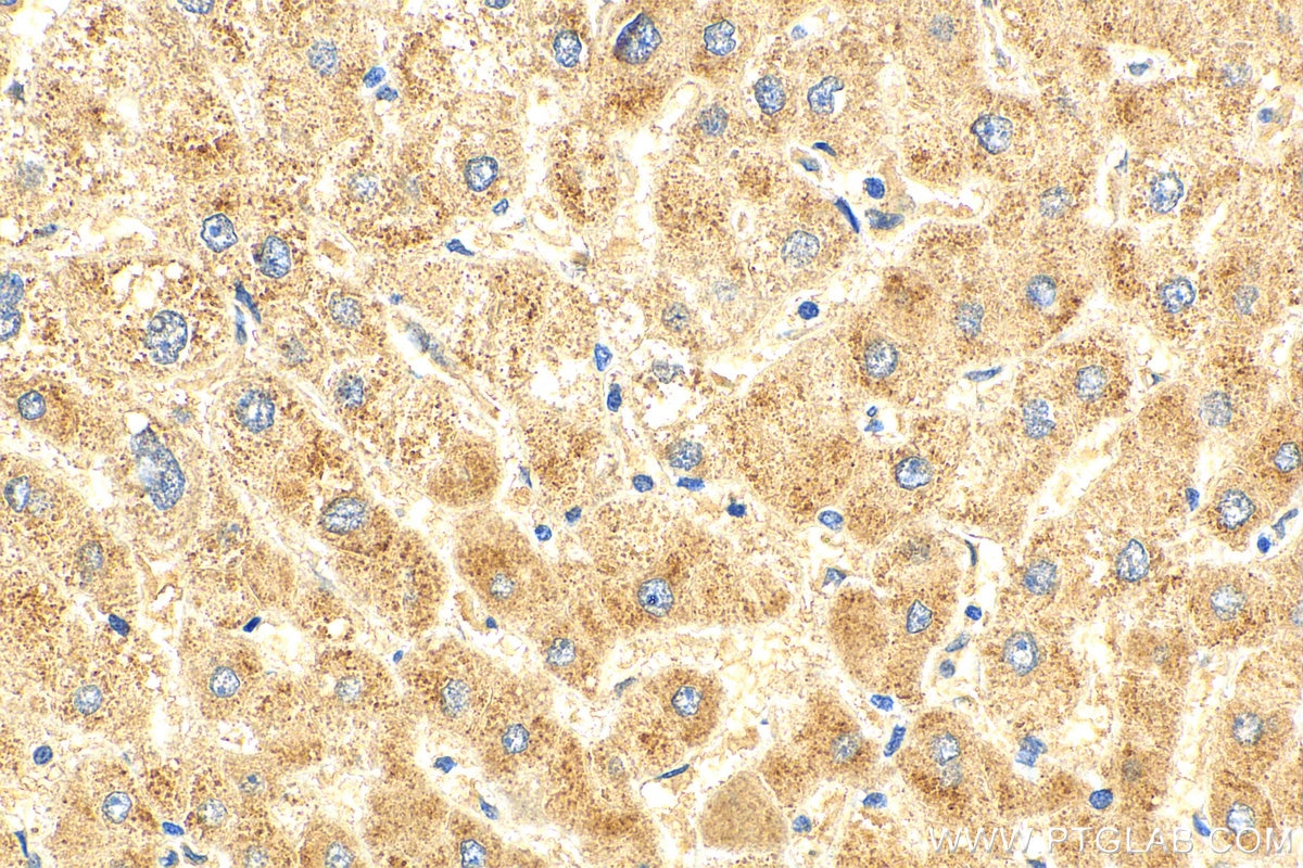 Immunohistochemistry (IHC) staining of human liver tissue using SPG7 Polyclonal antibody (27801-1-AP)