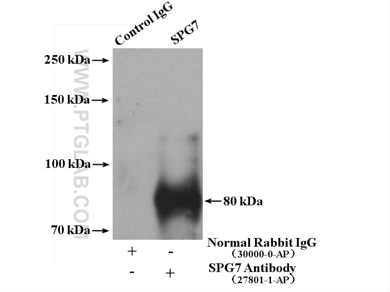 Immunoprecipitation (IP) experiment of HeLa cells using SPG7 Polyclonal antibody (27801-1-AP)