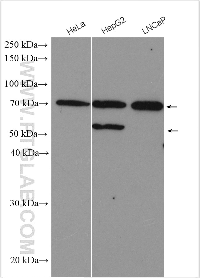 Western Blot (WB) analysis of various lysates using SPG7 Polyclonal antibody (27801-1-AP)