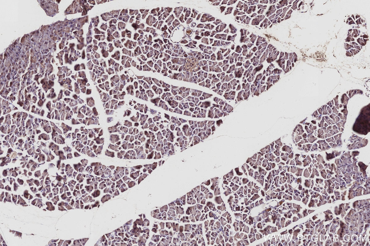 Immunohistochemistry (IHC) staining of mouse pancreas tissue using SPHK1 Polyclonal antibody (10670-1-AP)