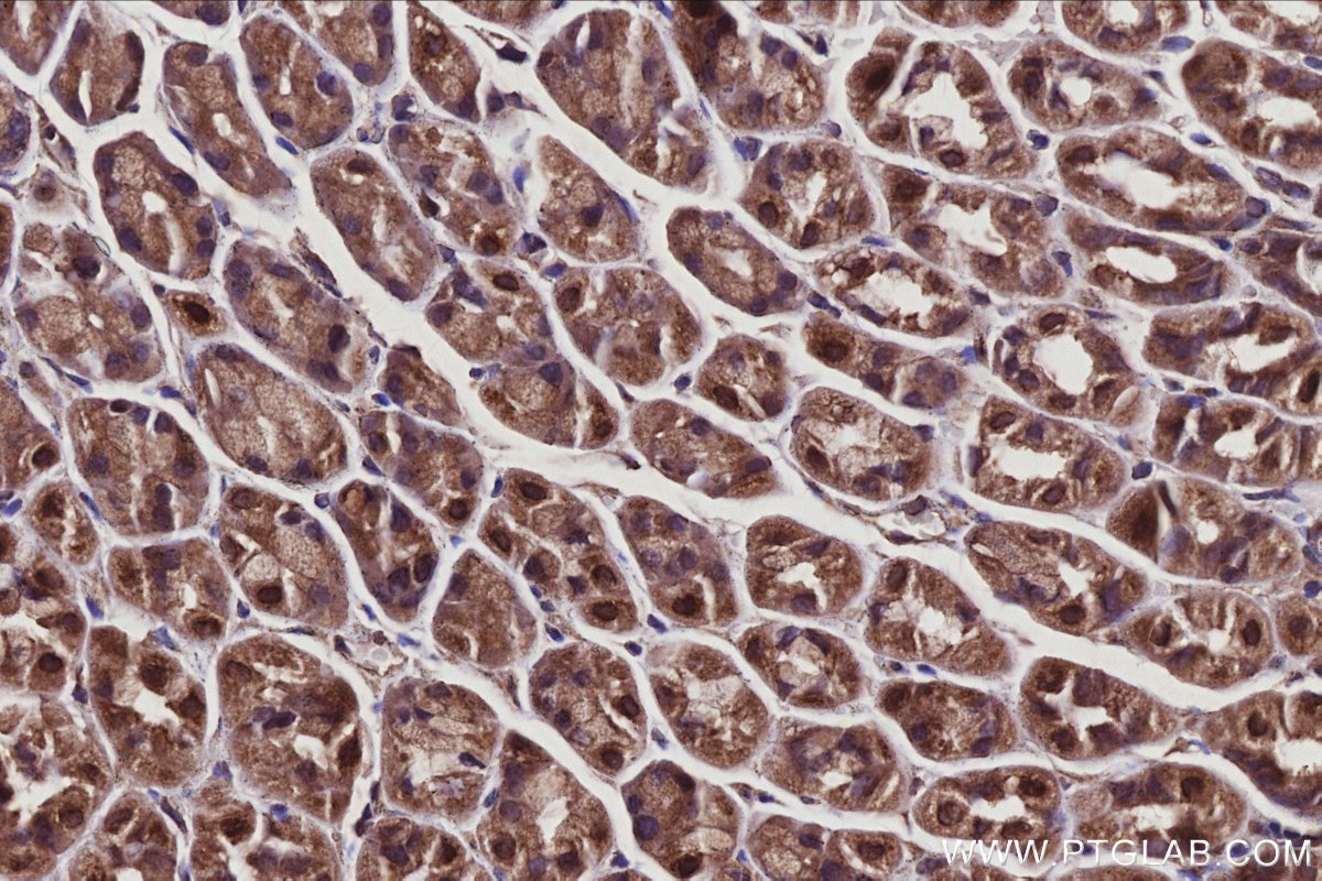 Immunohistochemistry (IHC) staining of mouse stomach tissue using SPHK1 Polyclonal antibody (10670-1-AP)