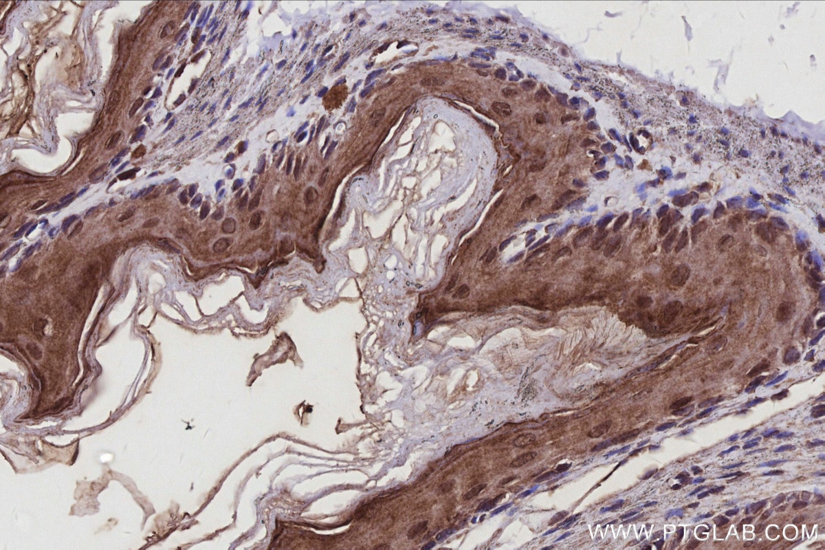 Immunohistochemistry (IHC) staining of mouse stomach tissue using SPHK1 Polyclonal antibody (10670-1-AP)