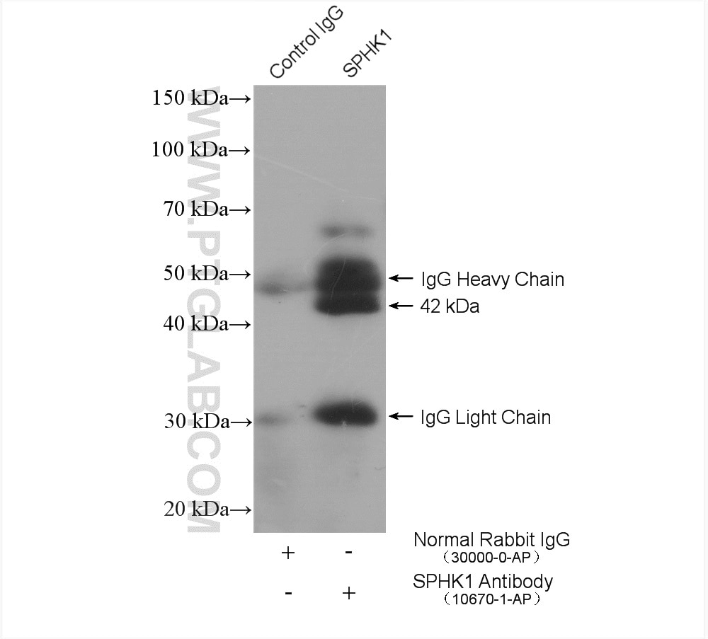 Immunoprecipitation (IP) experiment of L02 cells using SPHK1 Polyclonal antibody (10670-1-AP)
