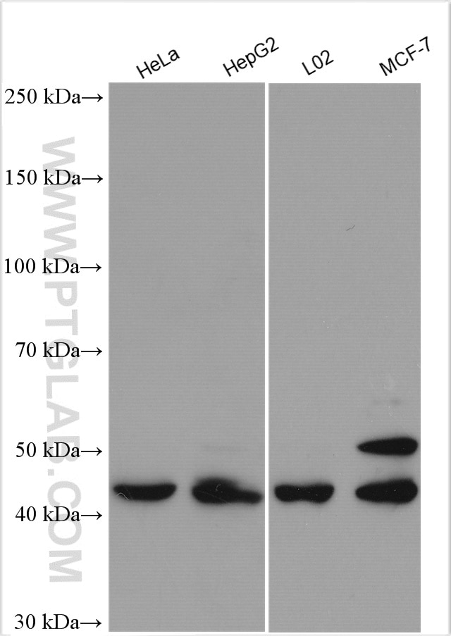 Western Blot (WB) analysis of various lysates using SPHK1 Polyclonal antibody (10670-1-AP)
