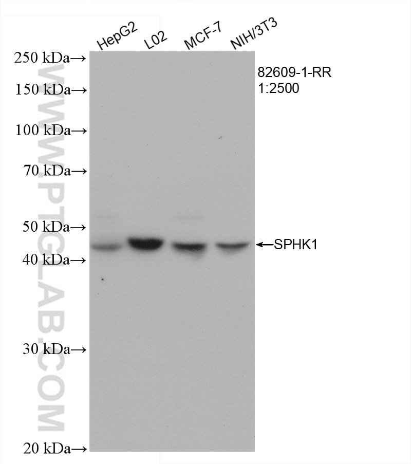 Western Blot (WB) analysis of various lysates using SPHK1 Recombinant antibody (82609-1-RR)