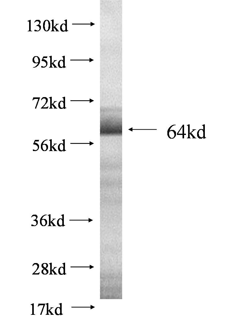 SPHK1 fusion protein Ag0505 SDS-PAGE