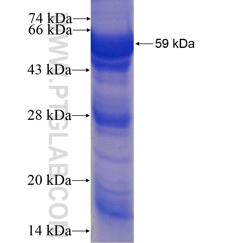 SPHK1 fusion protein Ag1051 SDS-PAGE