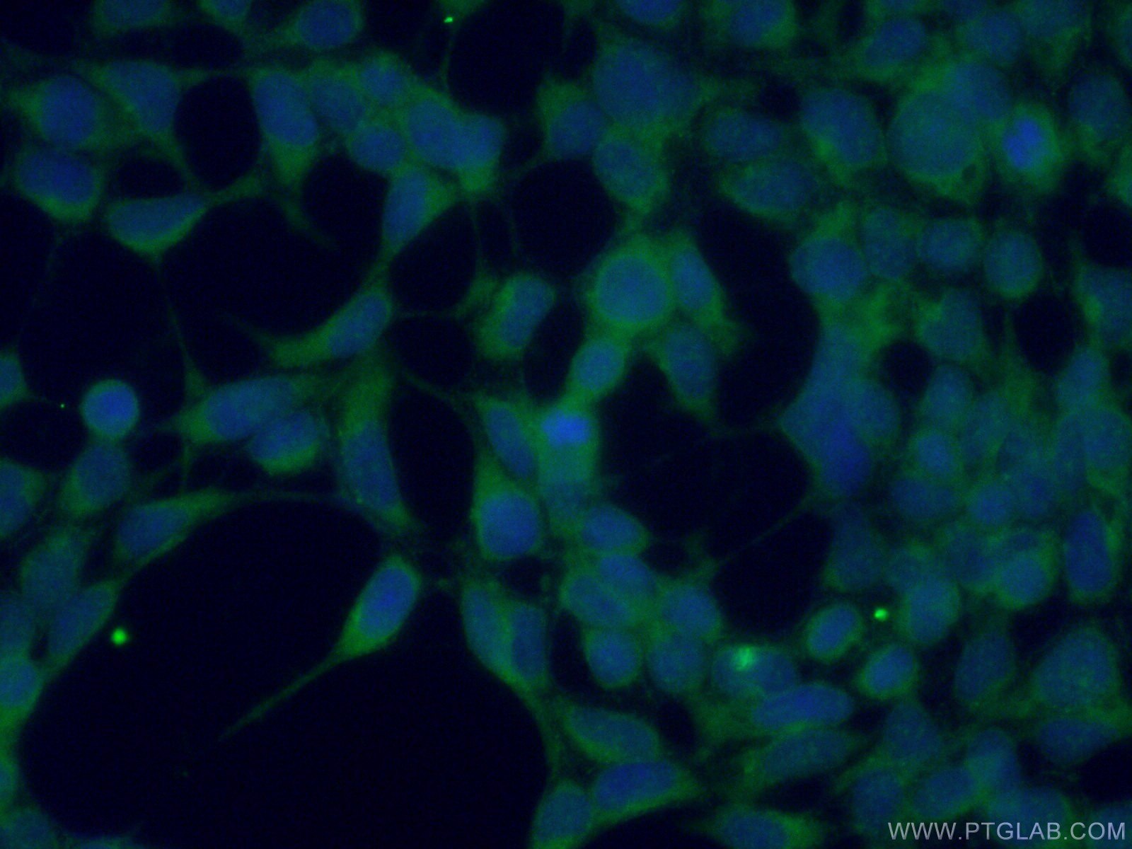 IF Staining of HEK-293 using 17096-1-AP