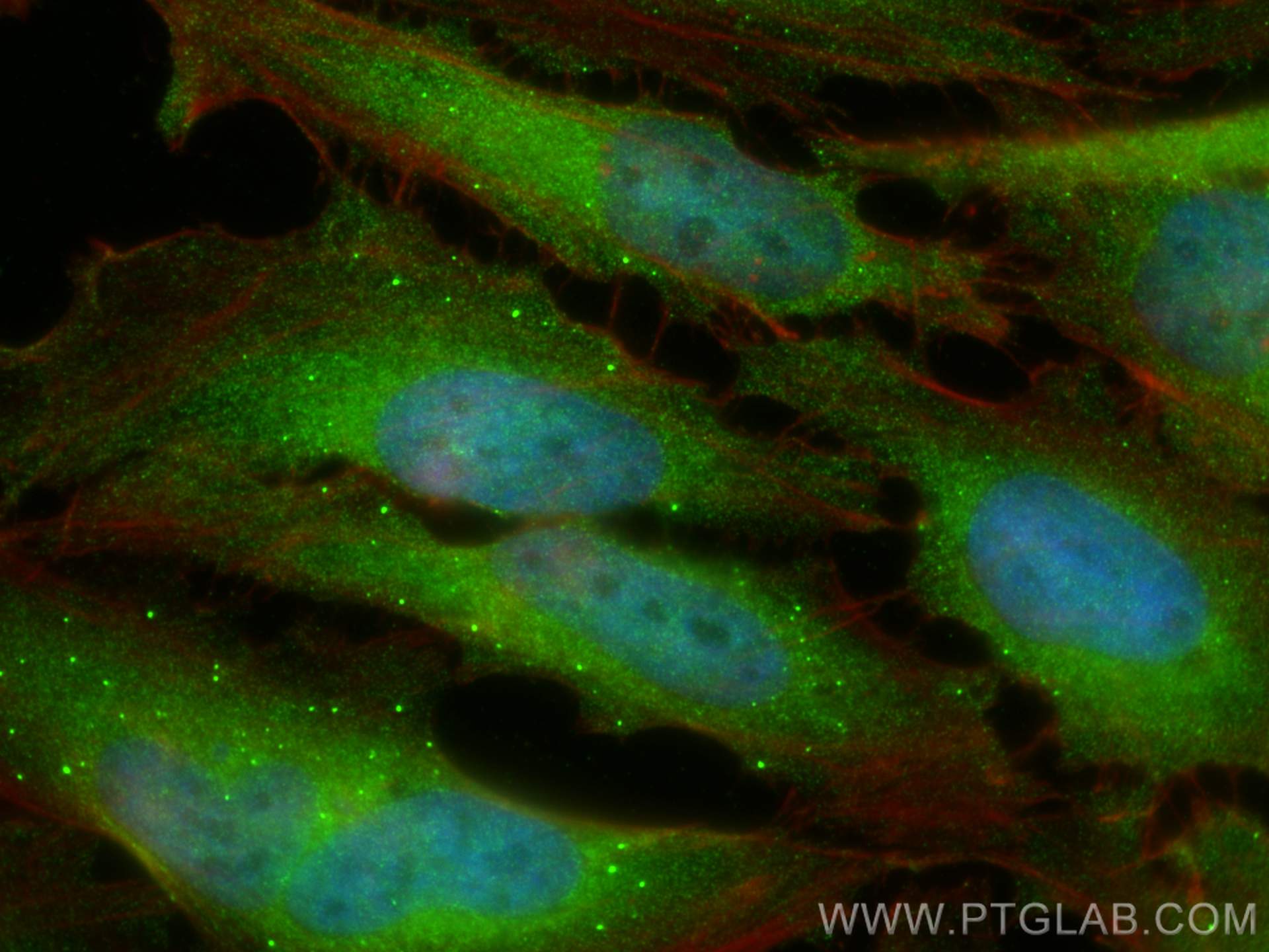 IF Staining of HeLa using 17096-1-AP