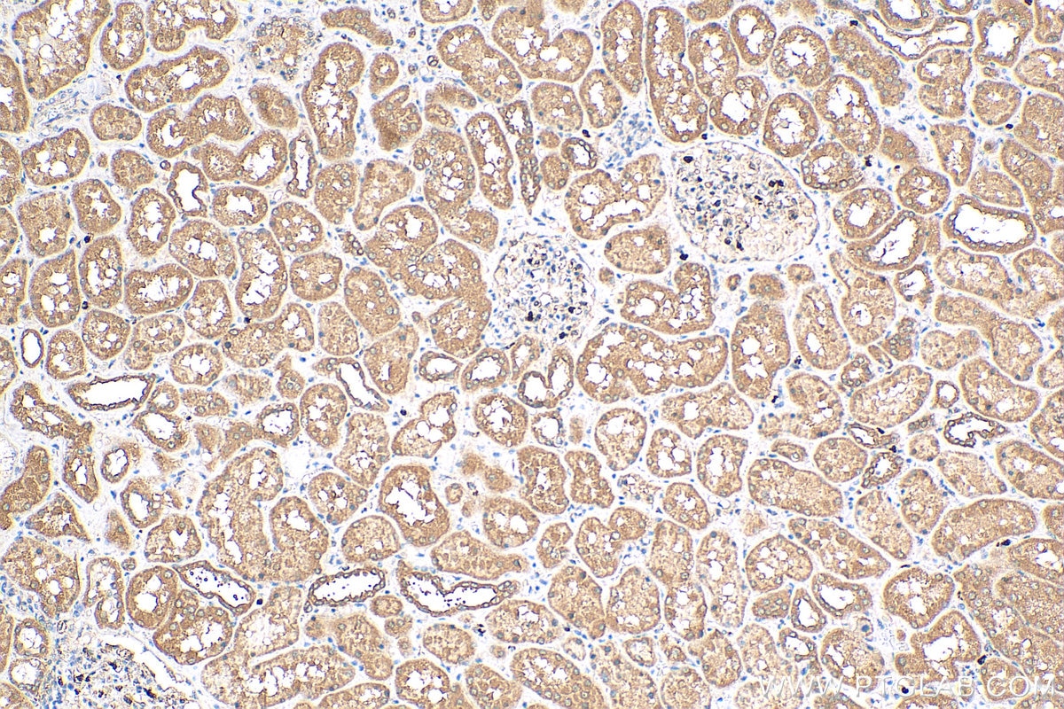 Immunohistochemistry (IHC) staining of human kidney tissue using SPHK2 Polyclonal antibody (17096-1-AP)