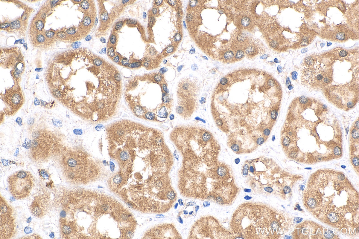 Immunohistochemistry (IHC) staining of human kidney tissue using SPHK2 Polyclonal antibody (17096-1-AP)