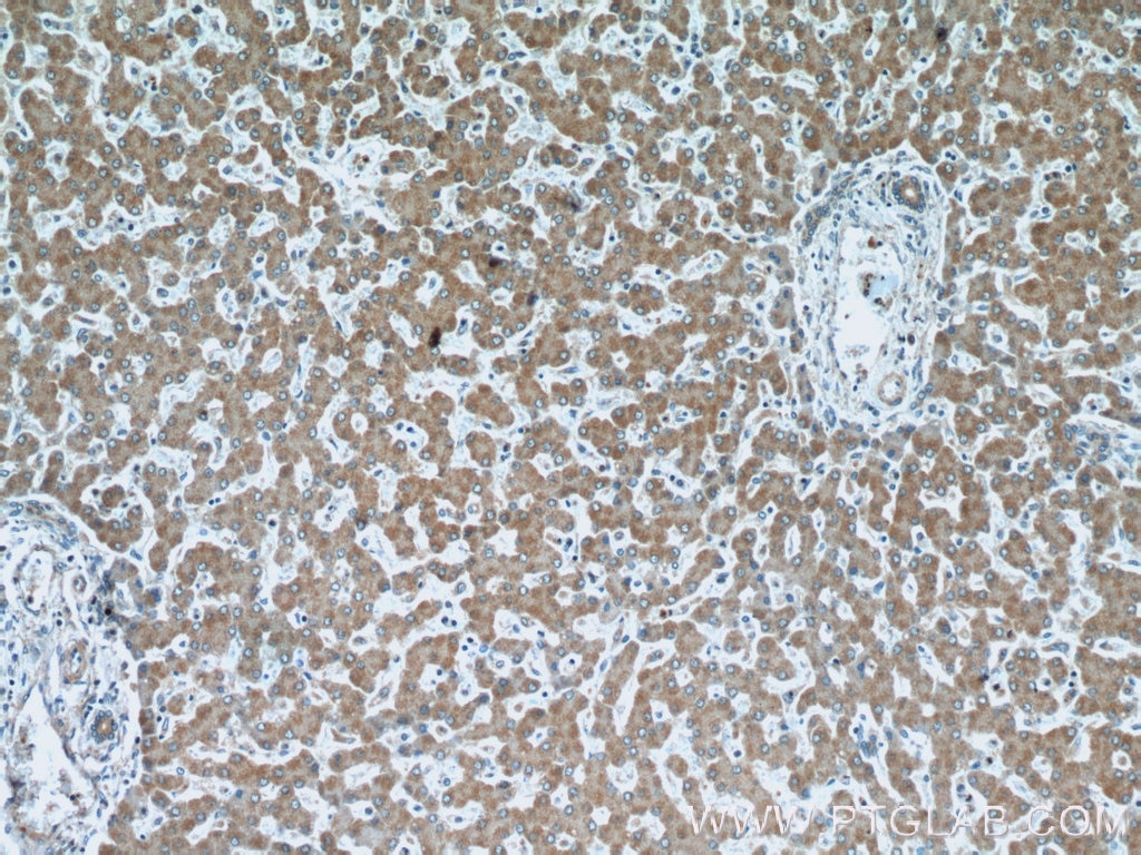 Immunohistochemistry (IHC) staining of human liver tissue using SPHK2 Polyclonal antibody (17096-1-AP)