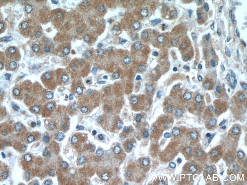 Immunohistochemistry (IHC) staining of human liver tissue using SPHK2 Polyclonal antibody (17096-1-AP)