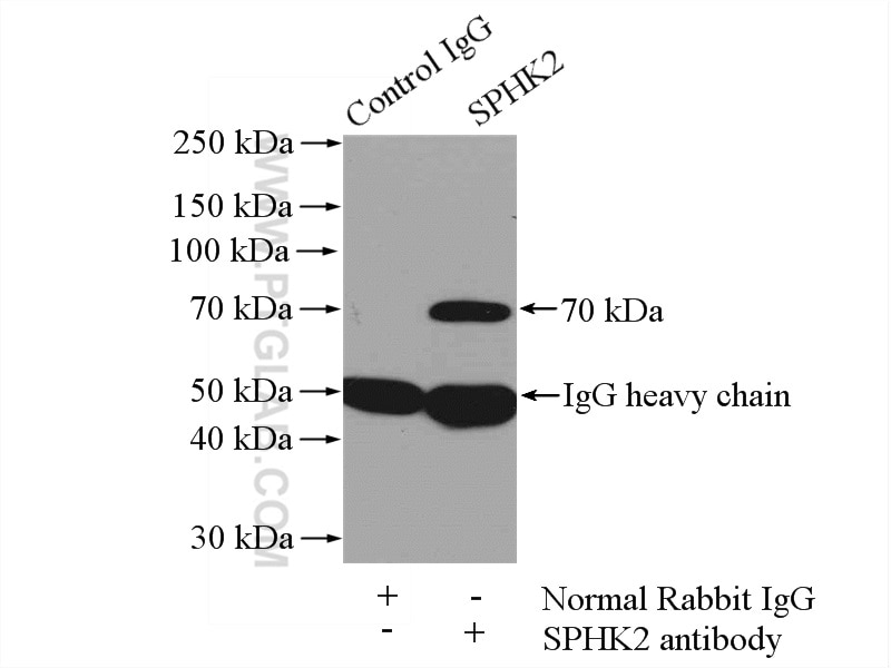 Immunoprecipitation (IP) experiment of mouse liver tissue using SPHK2 Polyclonal antibody (17096-1-AP)
