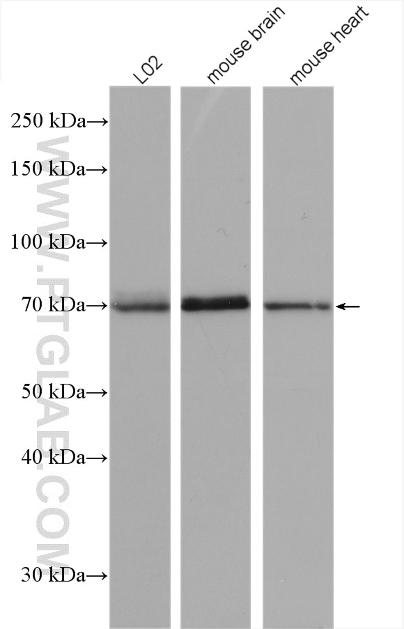Western Blot (WB) analysis of various lysates using SPHK2 Polyclonal antibody (17096-1-AP)
