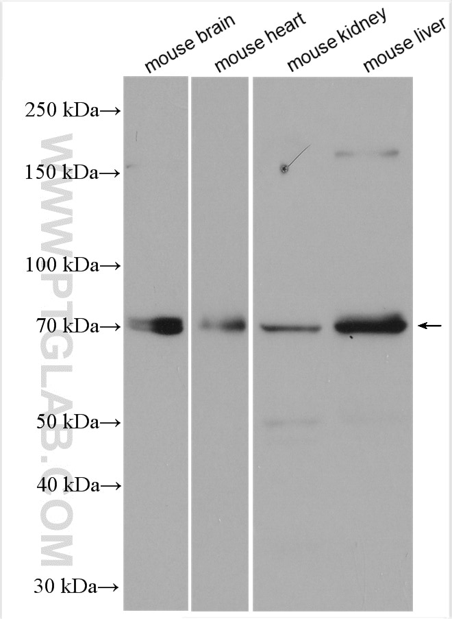 Western Blot (WB) analysis of various lysates using SPHK2 Polyclonal antibody (17096-1-AP)