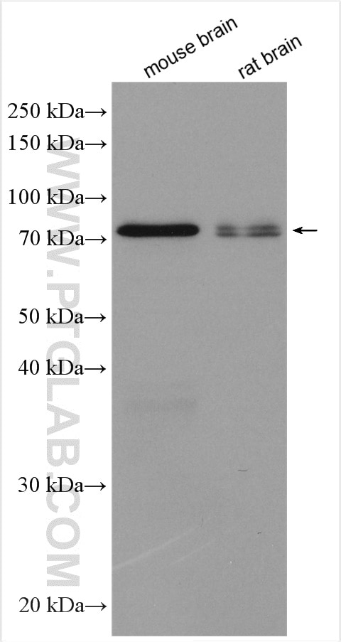 Western Blot (WB) analysis of various lysates using SPHK2 Polyclonal antibody (17096-1-AP)