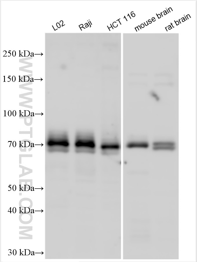 Western Blot (WB) analysis of various lysates using SPHK2 Polyclonal antibody (17096-1-AP)