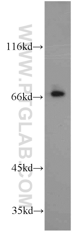 Western Blot (WB) analysis of human kidney tissue using SPHK2 Polyclonal antibody (17096-1-AP)