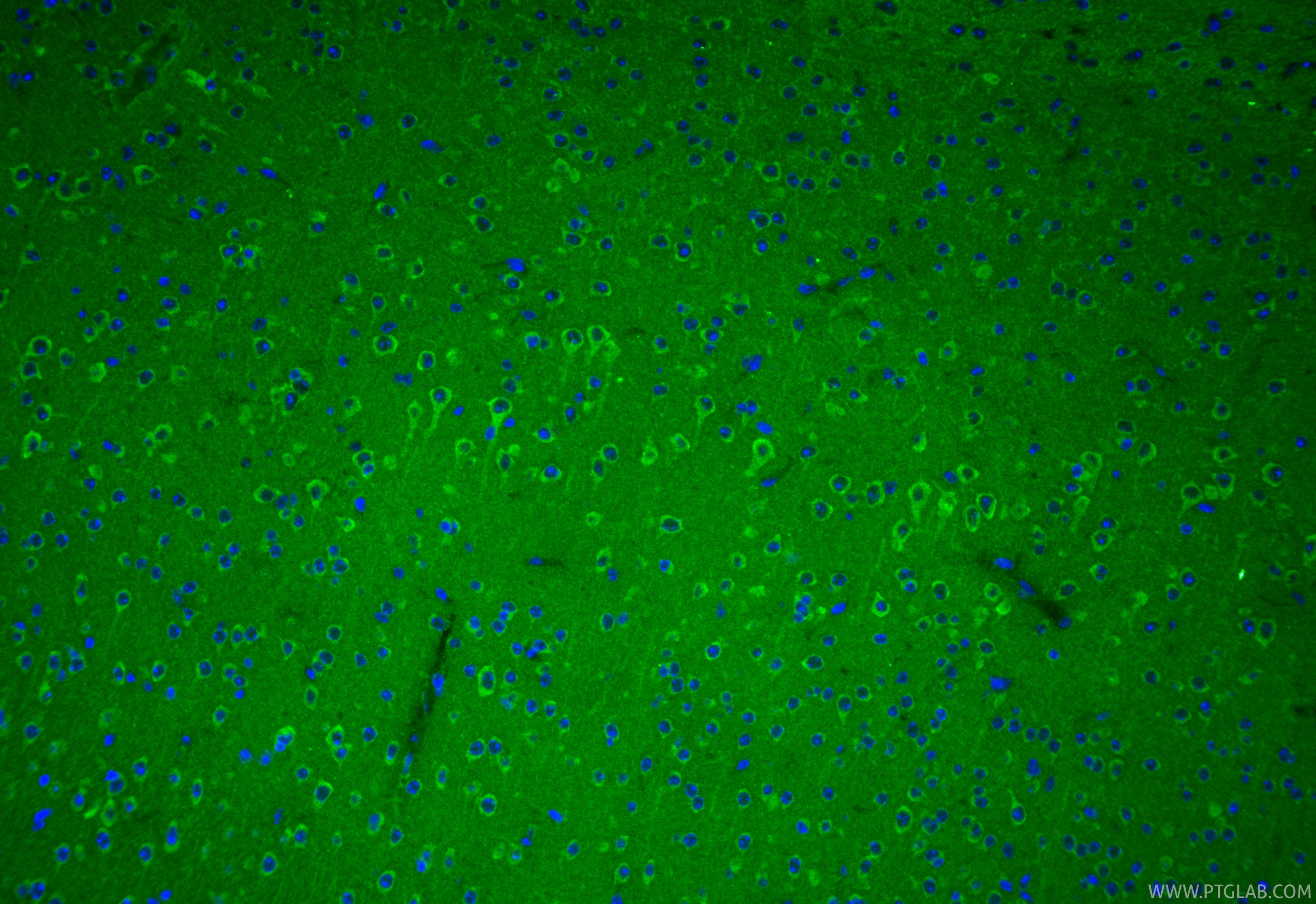 Immunofluorescence (IF) / fluorescent staining of mouse brain tissue using SPHK2 Monoclonal antibody (68871-4-Ig)