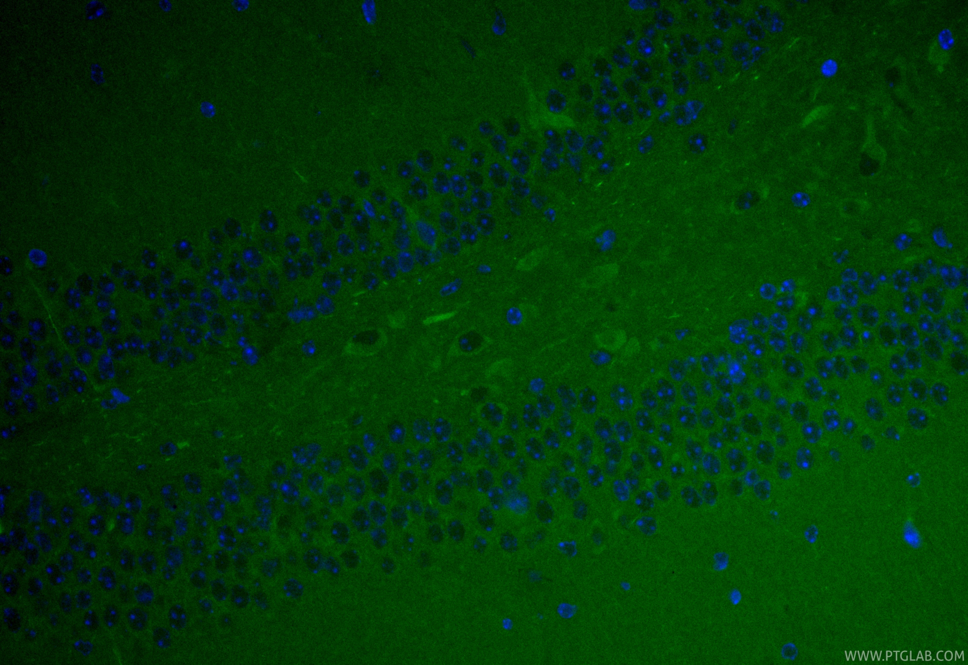 IF Staining of mouse brain using CL488-17096 Immunofluorescence (IF) / fluorescent staining of mouse brain tissue using CoraLite® Plus 488-conjugated SPHK2 Polyclonal ant (CL488-17096)