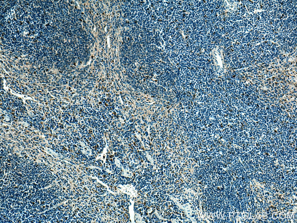 IHC staining of mouse spleen using 66618-2-Ig
