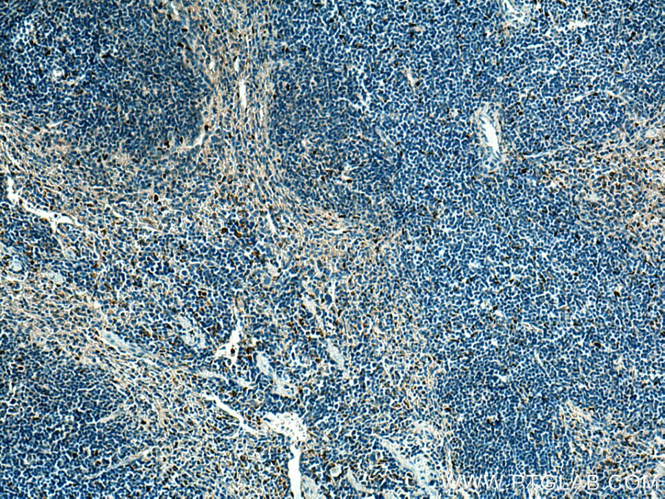 Immunohistochemistry (IHC) staining of mouse spleen tissue using SPI1 Monoclonal antibody (66618-2-Ig)