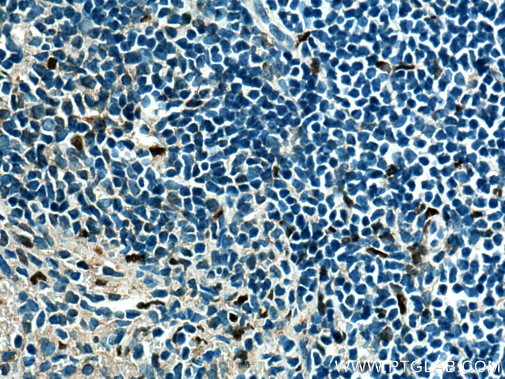 Immunohistochemistry (IHC) staining of mouse spleen tissue using SPI1 Monoclonal antibody (66618-2-Ig)