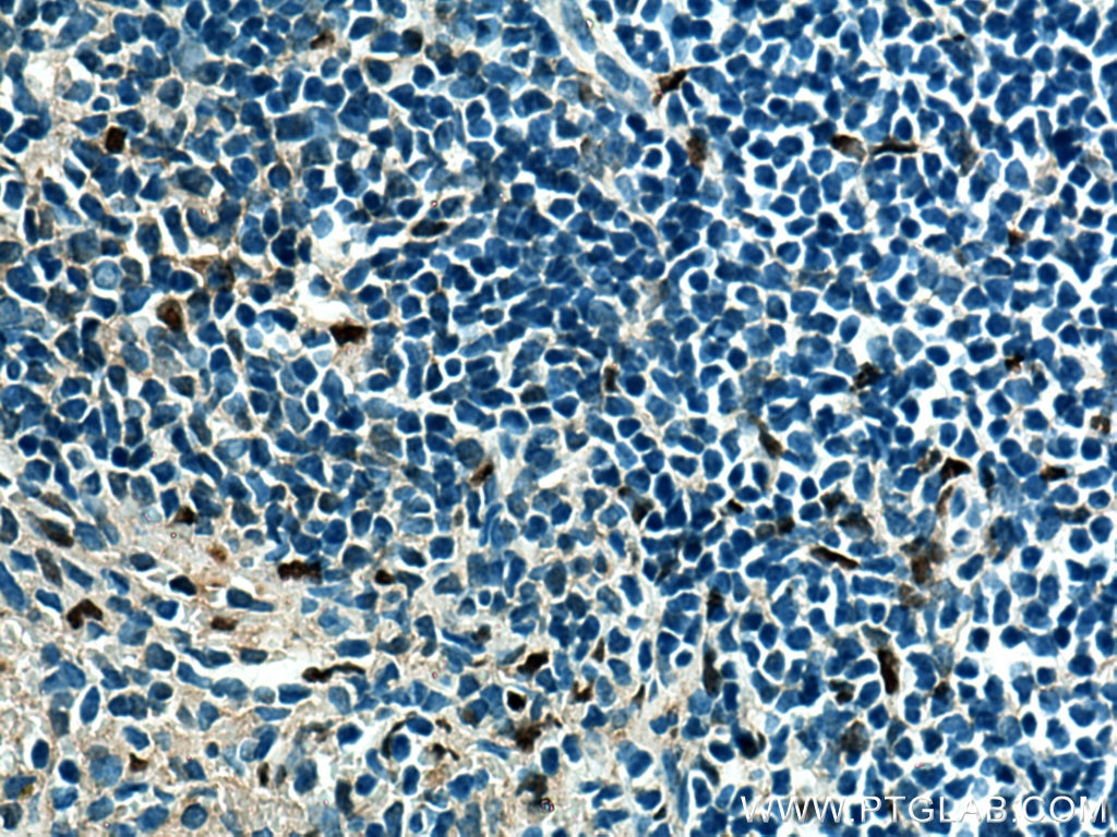 IHC staining of mouse spleen using 66618-2-Ig