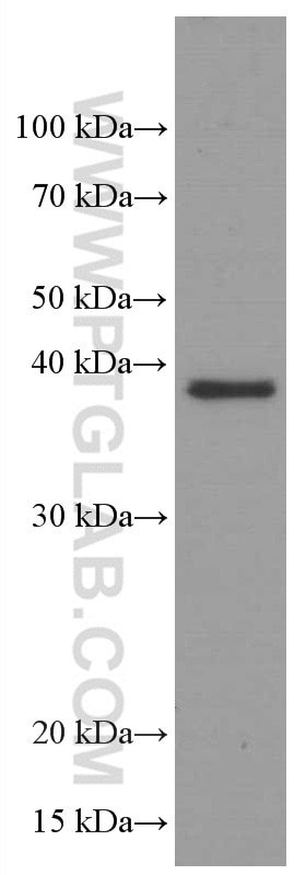 WB analysis of Raji using 66618-2-Ig