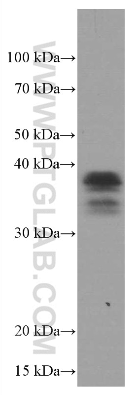 WB analysis of RAW 264.7 using 66618-2-Ig