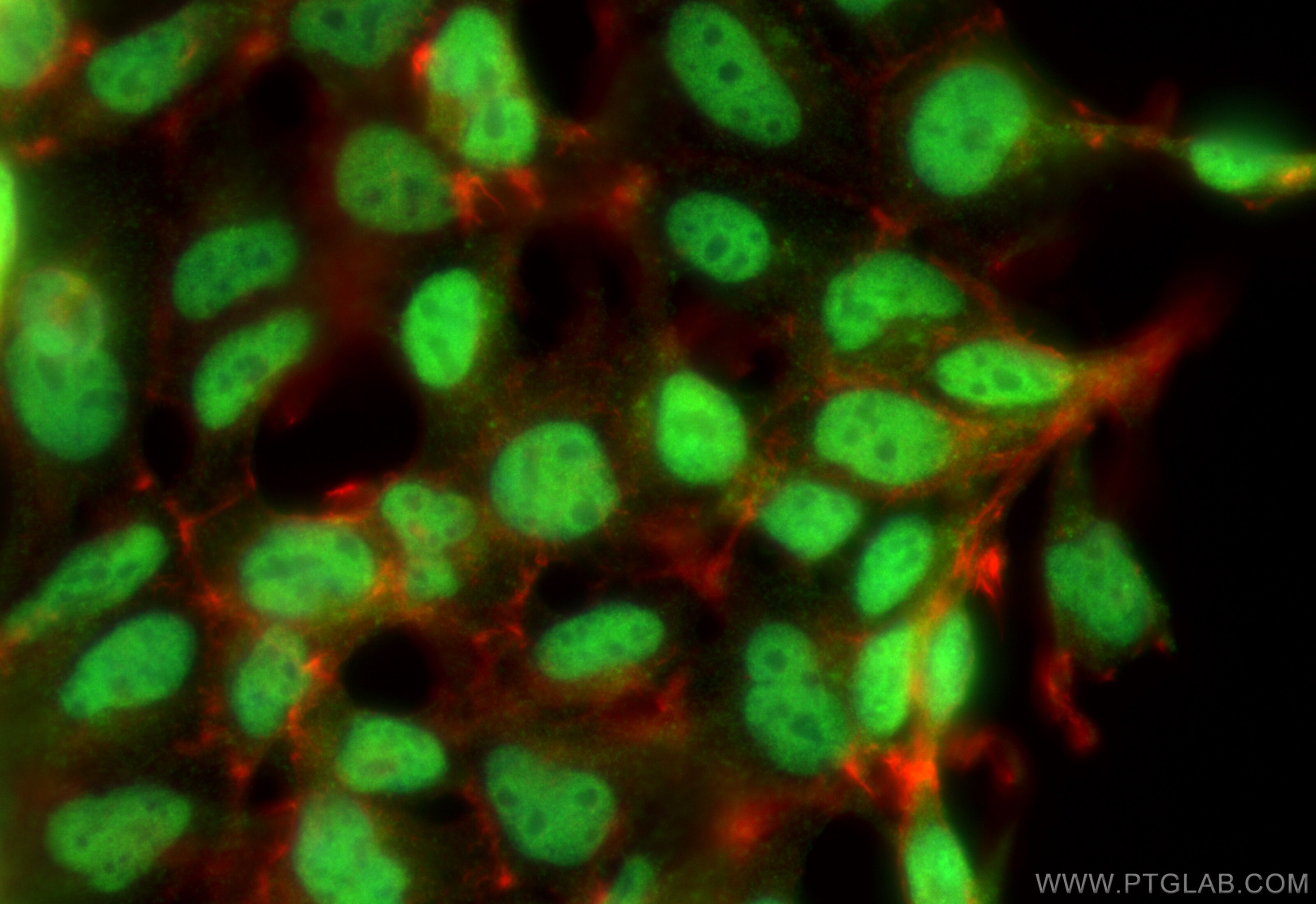 Immunofluorescence (IF) / fluorescent staining of HEK-293 cells using SPIN1 Polyclonal antibody (12105-1-AP)
