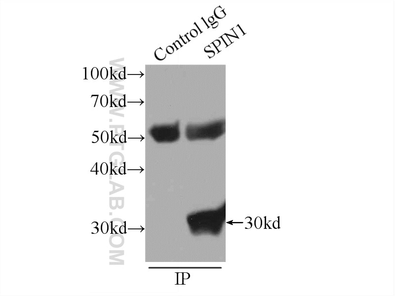 Immunoprecipitation (IP) experiment of HeLa cells using SPIN1 Polyclonal antibody (12105-1-AP)